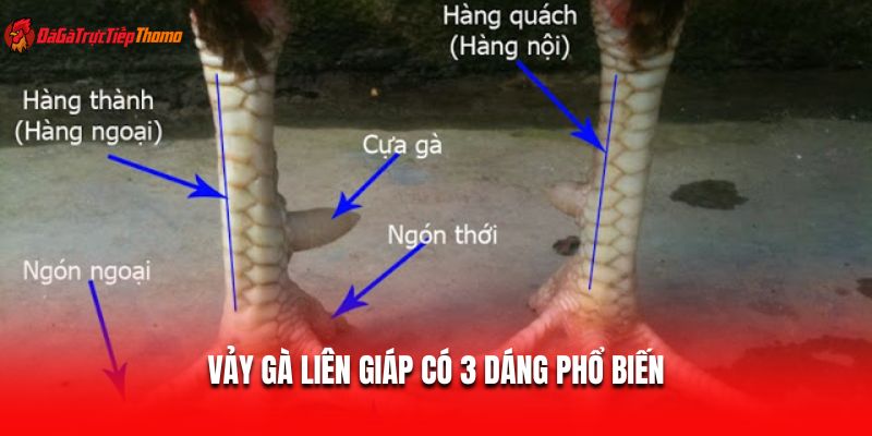 Vảy gà liên giáp có 3 dáng phổ biến